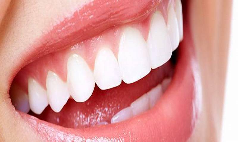 Smile Makeover